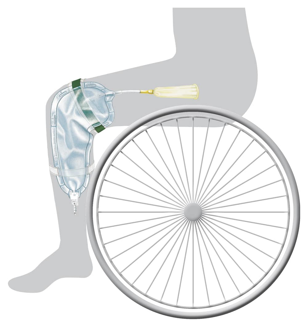 SAUER Rollibeutel (Urinbeutel) – Bild 3